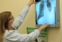 Série de vídeos traz dicas para tratamento adequado da tuberculose