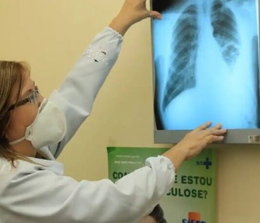 Série de vídeos traz dicas para tratamento adequado da tuberculose